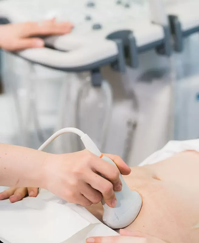 Ultrassonografia transvaginal para contagem de folículos